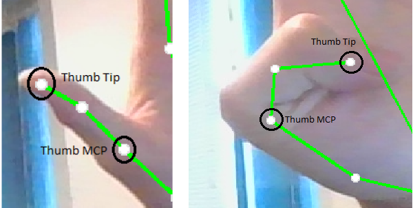 Thumb-tip-and-thumb-MCP