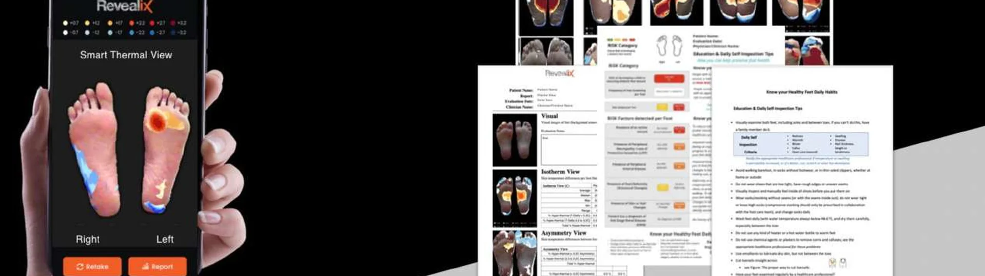 Revealix smart thermal view showing foot risk levels 0, 1, and 2 in the mobile application