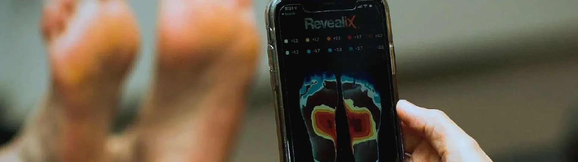 Revealix mobile app displaying thermal foot scan for diabetic wound prevention